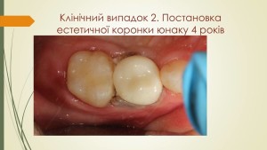 ▒РЮМДЮПМШЕ ЙНПНМЙ и_Ковнацкий_3